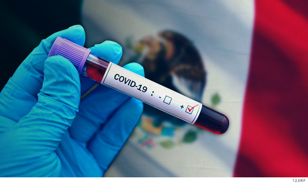 Muestra de sangre para detectar covid-19